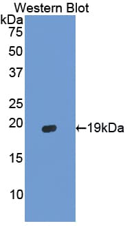 HBA1+2 / Hemoglobin Alpha Antibody (aa2-142)