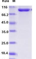 Human AGO2 / EIF2C2 Protein (Recombinant His,N-terminus)