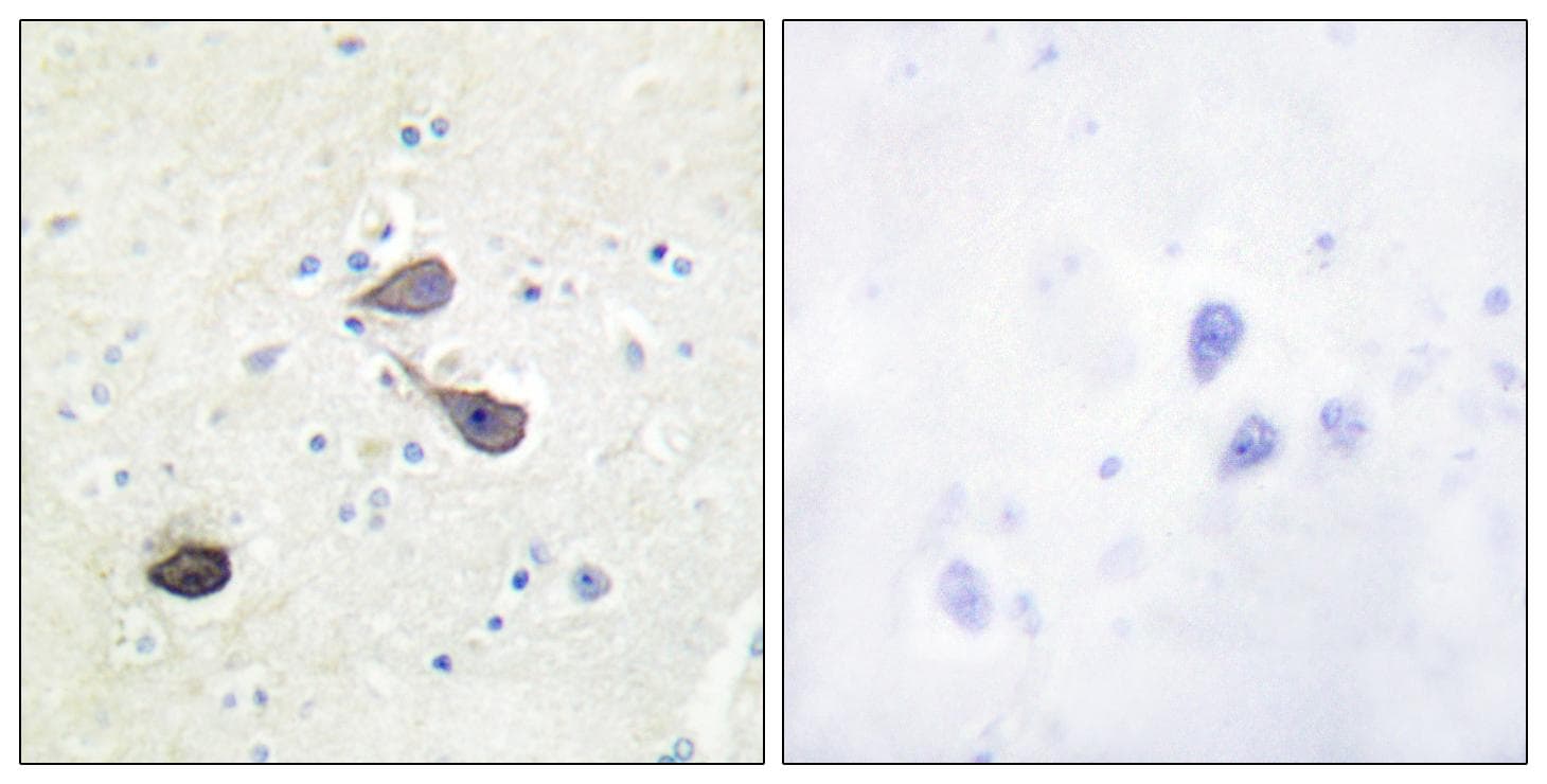OPRK1 / Kappa Opioid Receptor Antibody (Ab-369)