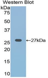 FZD1 / Frizzled 1 Antibody (aa117-322)