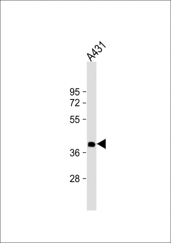 NMI Antibody (clone 1580CT730.43.59)