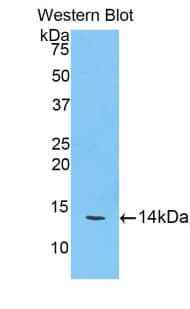 CTSD / Cathepsin D Antibody (aa54-163)