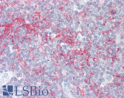 IHC-plus™ Polyclonal Rabbit anti-Human PIP5K1C Antibody (Internal, IHC, WB)
