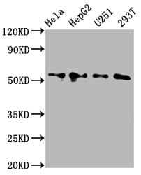 Polyclonal Rabbit anti-Human CCT6A Antibody (WB)