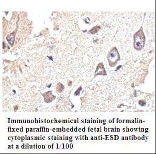 Esterase D / ESD Antibody (aa147-282)