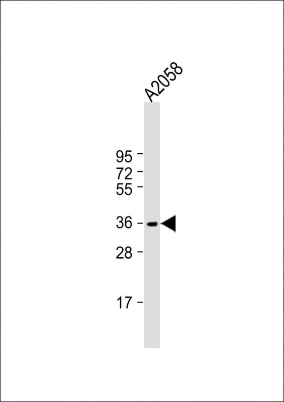 IGHA1 / IgA1 Antibody (aa 290-320, C-Term)