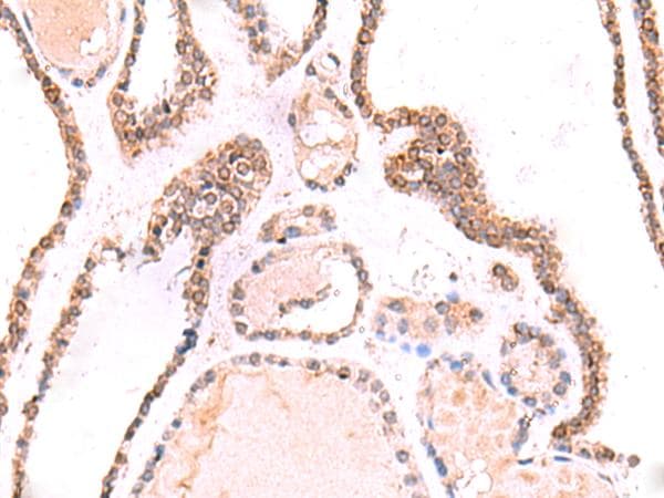 TOR1AIP1 / LAP1 Antibody