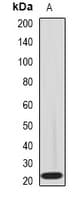 IL18BP Antibody