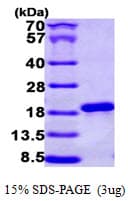 Human NCBP2 / CBP20 Protein (Recombinant His)