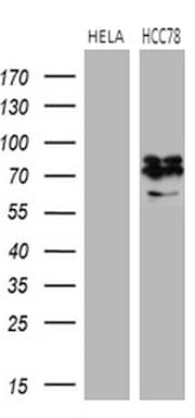 ROS1 / ROS Antibody (aa2126-2347, clone OTI7E4, Carrier-free)