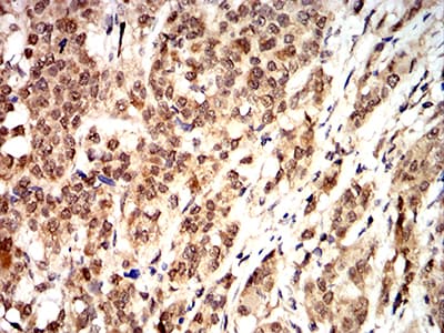IHC-plus™ CCND1 / Cyclin D1 Antibody (clone 3B6G3)