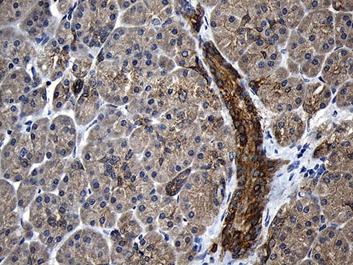 CPT1B Antibody (aa187-440, clone OTI2A6, Carrier-free)