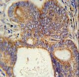 Polyclonal Rabbit anti-Human LYSMD1 Antibody (aa198-227, IHC, WB)