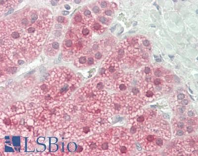 IHC-plus™ Polyclonal Rabbit anti-Human INPP4B Antibody (IHC, WB)