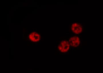 HNRNPC / HNRNP C Antibody