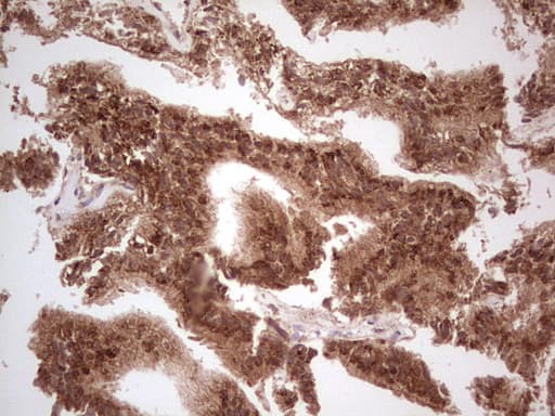 UBE2D2 / UBCH5B Antibody (clone OTI2C2, Carrier-free)