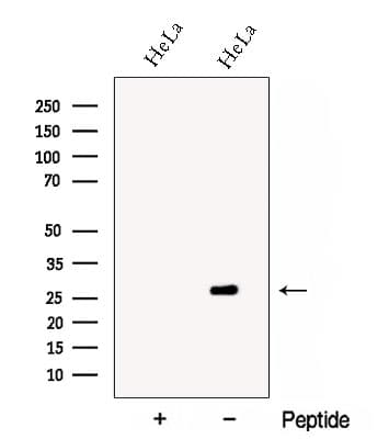 CYGB / Cytoglobin Antibody