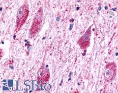 PathPlus™ Polyclonal Rabbit anti-Human TPRA1 / GPR175 Antibody (N-Terminus, IHC)