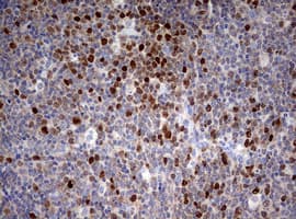 Monoclonal Mouse anti-Human TOP2A / Topoisomerase II Alpha Antibody (clone OTI2F8, aa1100-1531, IHC, WB)