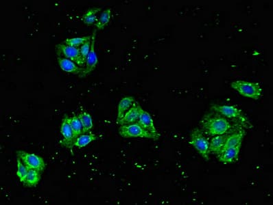 ZNF645 Antibody