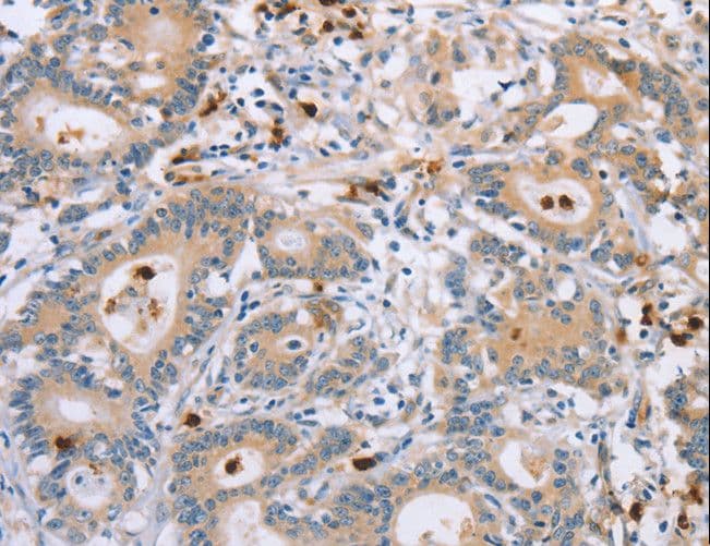 Polyclonal Rabbit anti-Human KLK4 / Kallikrein 4 Antibody (IHC)