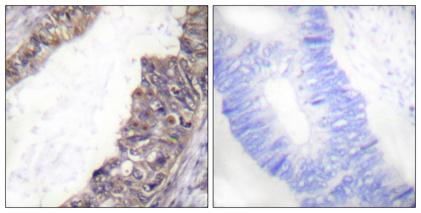 KCNJ3 / GIRK1 Antibody (phospho-Ser185)