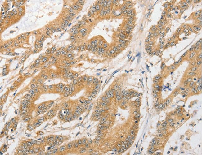 Polyclonal Rabbit anti-Human APG5 / ATG5 Antibody (IHC)