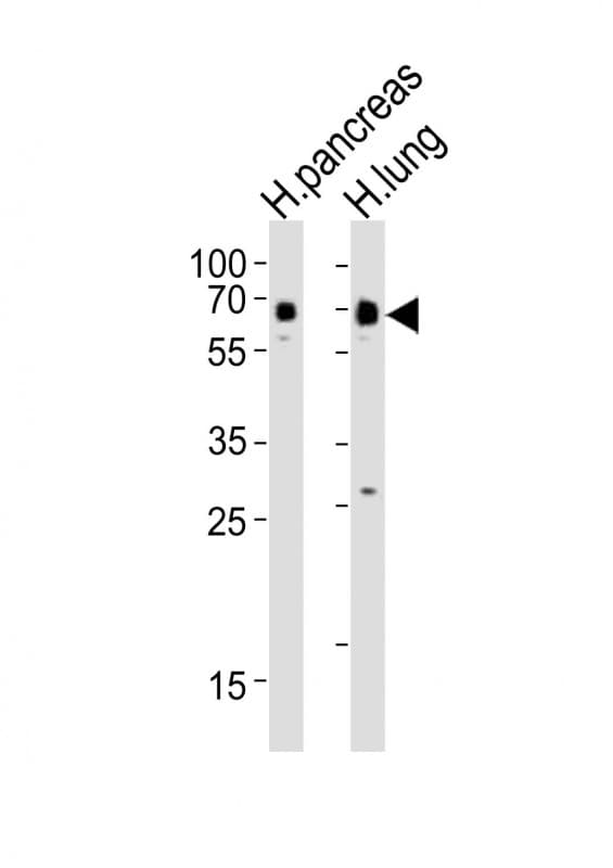 SSTR1 Antibody (aa367-403)