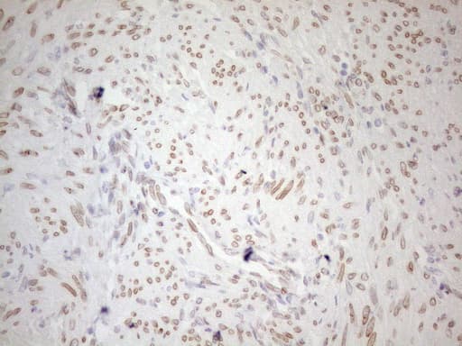 PELI1 / Pellino 1 Antibody (aa1-245, clone OTI13F8)