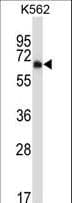 DYRK2 Antibody (aa521-549)
