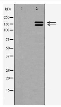 Hamartin / TSC1 Antibody