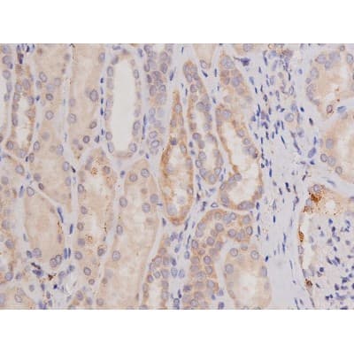 Polyclonal Rabbit anti-Human c-Kit / CD117 Antibody (IHC, IF, WB)