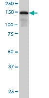 IHC-plus™ SAFB1 / SAFB Antibody (clone 5A11)