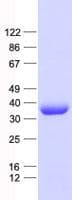 Human PP2CB / PPP2CB Protein (Recombinant His, N-Terminal)