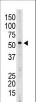 SIGLEC6 Antibody (aa381-412)