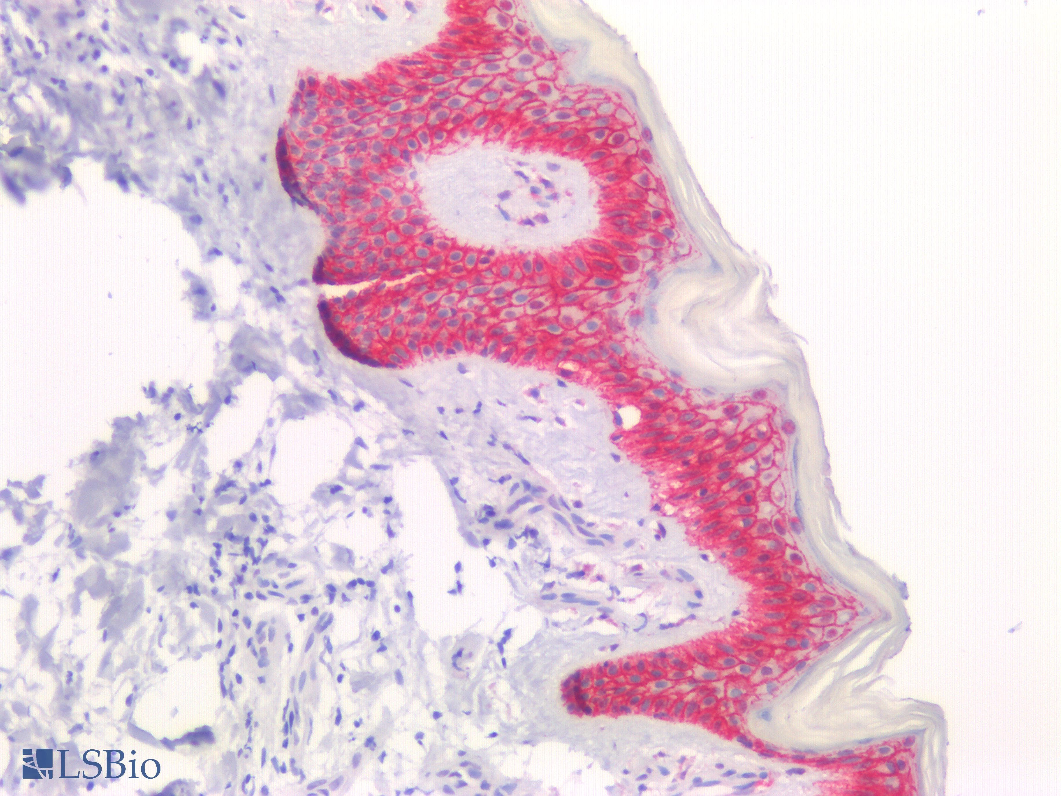 PathPlus™ CDH1 / E Cadherin Antibody (N-Terminus)