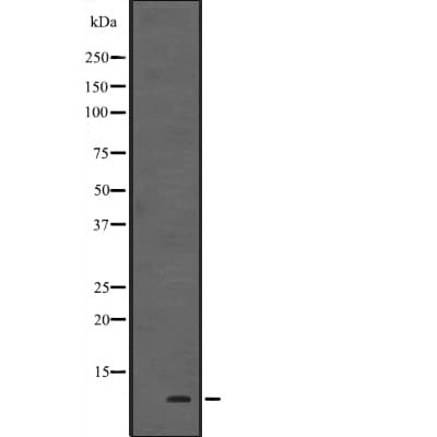 Polyclonal Rabbit anti-Human HOPX / HOP Antibody (IHC, WB)