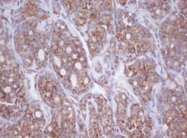 IF3mt / MTIF3 Antibody (aa56-278, clone OTI4B6)