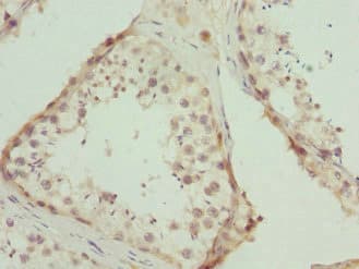 CALCOCO1 / CoCoa Antibody