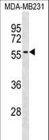 Polyclonal Rabbit anti-Human AKAP5 / AKAP79 Antibody (aa115-143, WB)
