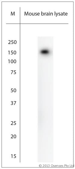 NEFH / NF-H Antibody (aa150-200)