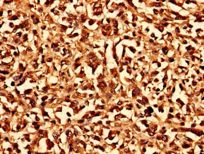 CHMP6 Antibody