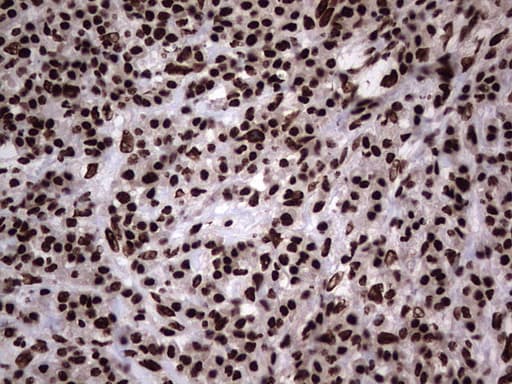 HNRNPL / hnRNP L Antibody (aa270-502, clone OTI9G7, Carrier-free)