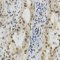 POLR3A Antibody (N-Terminus)