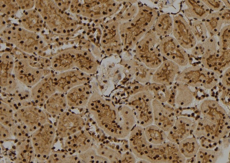 FUBP1 Antibody