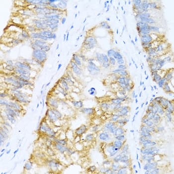 BMP2 Antibody