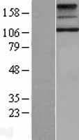 TSH Receptor / TSHR Protein (Over-Expression Lysate Myc-DDK (Flag))