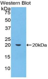 PON1 / ESA Antibody (aa35-206, Biotin)