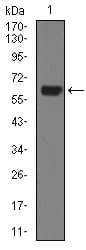 KRT5 / CK5 / Cytokeratin 5 Antibody (aa316-590, clone 10C11E6)