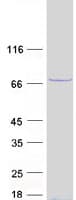 Human YTHDF1 Protein (Recombinant Myc-DDK (Flag))
